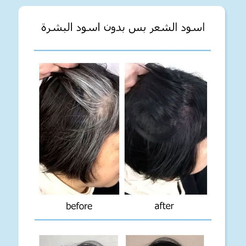 Plant-derived hair dye that can cover gray hair اشتري 1 و إحصول على 1 مجانا